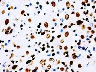 Anti-Aquaporin 1/AQP1 Antibody