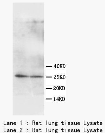 Anti-Aquaporin 5/AQP5 Antibody