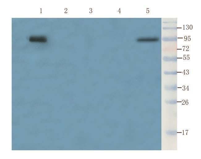 Aquaporin 9 antibody