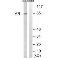AR (Ab-363) antibody