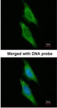 ARA9 Rabbit Polyclonal Antibody