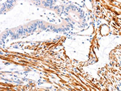 ARAP1 Antibody