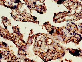 ARAP1 Antibody