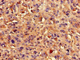 ARAP3 Antibody