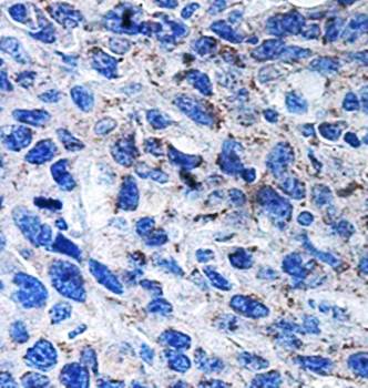 ARAP3 antibody