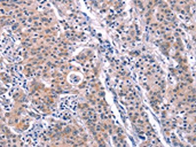 ARC Antibody