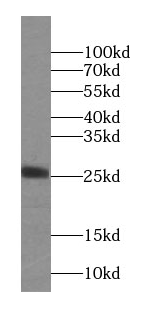 ARD1B antibody
