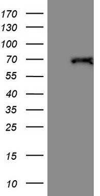 AREB6 (ZEB1) antibody