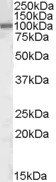 Goat anti-AREB6 / ZEB1 Antibody