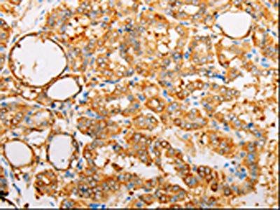 ARF1 antibody