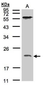 ARF1 antibody