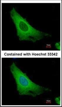 ADP ribosylation factor 3 Antibody