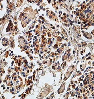 ARF3 Rabbit Polyclonal Antibody
