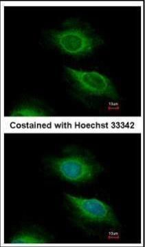 ADP ribosylation factor 5 Antibody