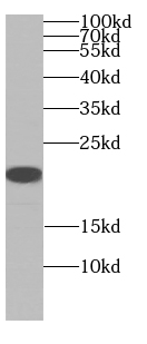 ARF5-Specific antibody