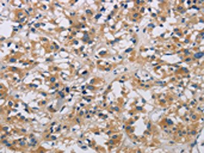 ARF6 antibody