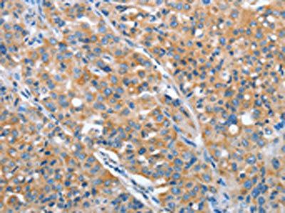 ARFGAP1 Antibody