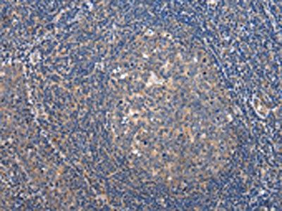 ARFGAP2 Antibody