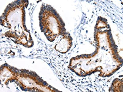 ARFGAP2 Antibody