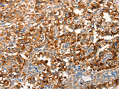 ARFGEF2 antibody