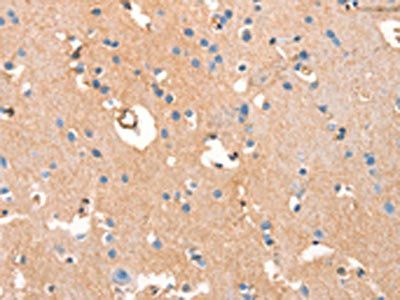 ARFGEF2 Antibody