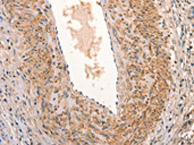 ARFRP1 Antibody