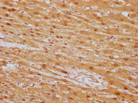 ARG1 Monoclonal Antibody