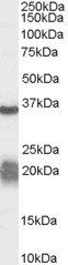 Goat anti-Arginase, type 1 / ARG1 Antibody