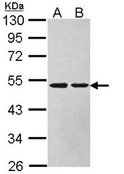 Argininosuccinate Lyase antibody