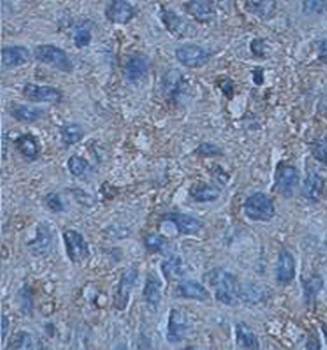 ARH3 Rabbit Polyclonal Antibody