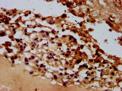 ARHGAP15 Antibody