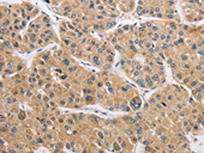 ARHGAP15 Antibody