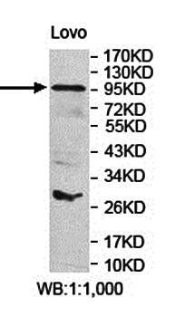 ARHGAP17 antibody