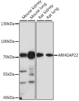 ARHGAP22 antibody