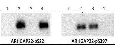 ARHGAP22 (phospho-S22) antibody