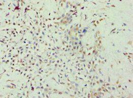 ARHGAP26 antibody