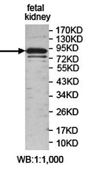 ARHGAP26 Rabbit Polyclonal Antibody