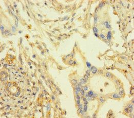 ARHGAP27 Antibody