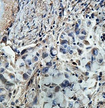 ARHGAP27 Rabbit Polyclonal Antibody
