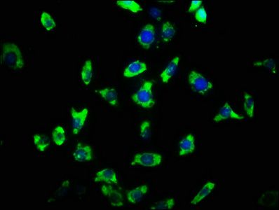 ARHGAP32 Antibody