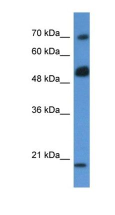 ARHGAP36 antibody