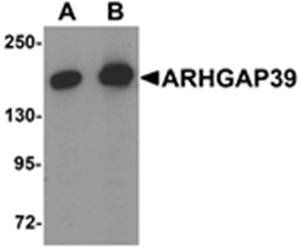 ARHGAP39 Antibody