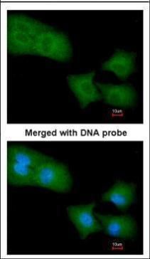 ARHGAP4 antibody [N1N2], N-term