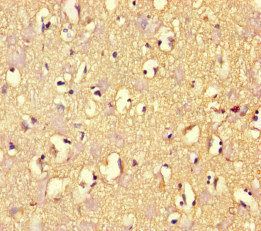 ARHGAP42 Antibody