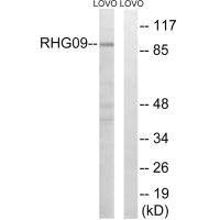 ARHGAP9 Antibody