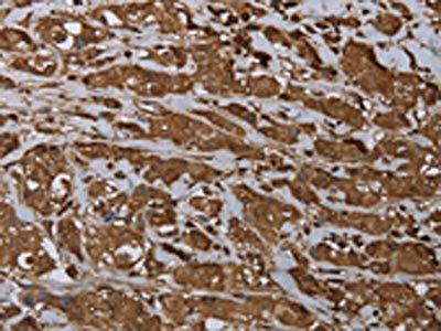 ARHGDIA Antibody
