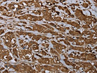 ARHGDIA antibody