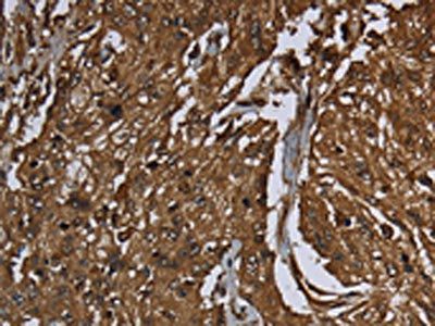 ARHGDIA Antibody