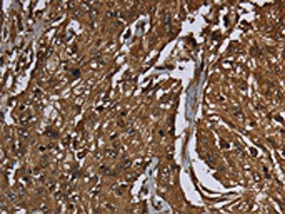 ARHGDIA antibody