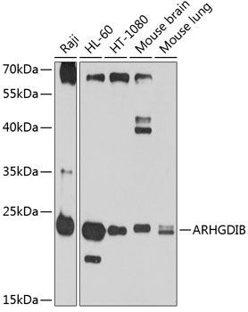 ARHGDIB antibody